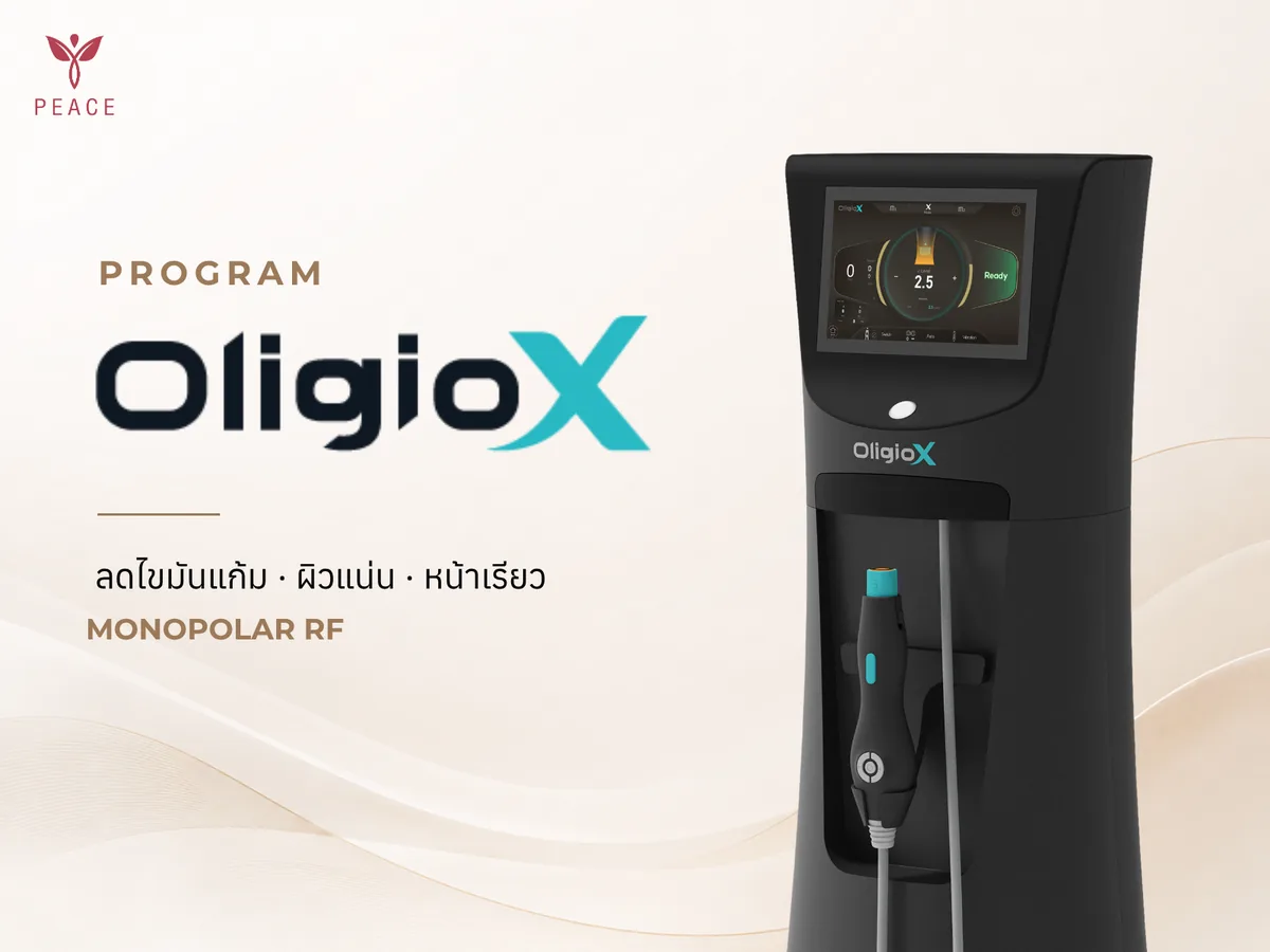 Oligio X กระชับผิวหน้า ที่ Peace Clinic แม่สอด