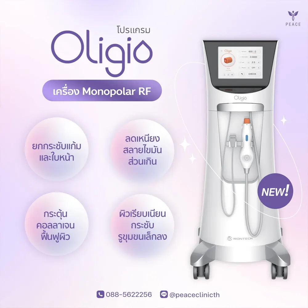 Oligio แม่สอด