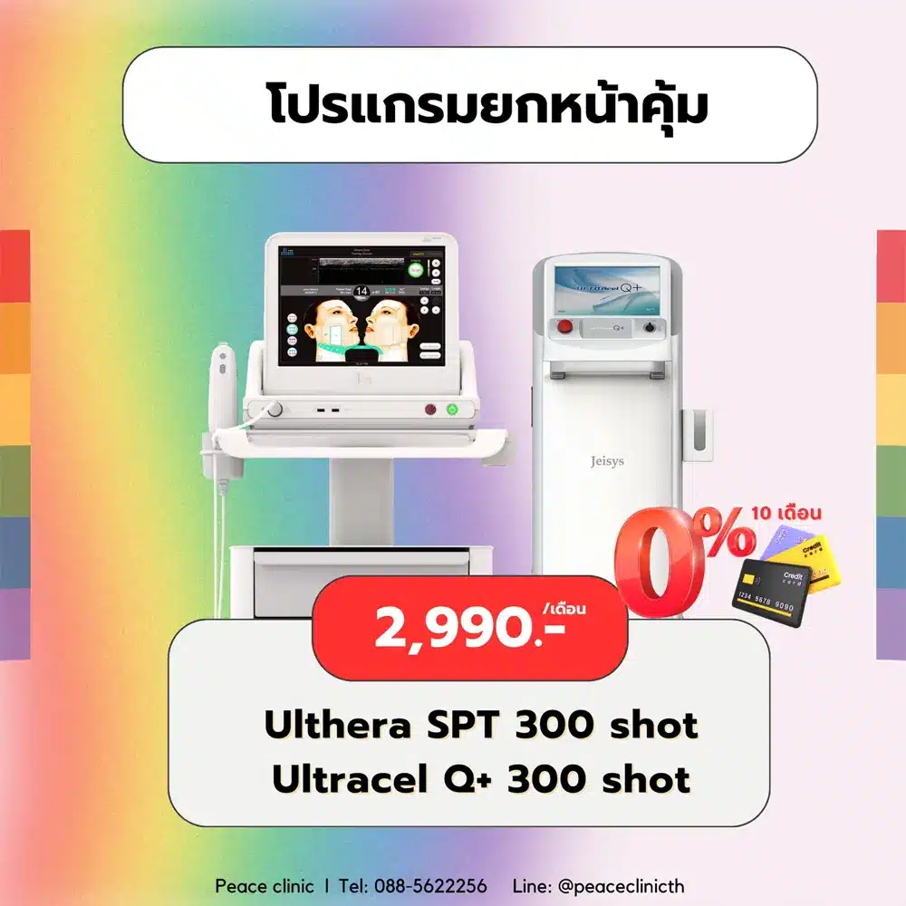 Ulthera แม่สอด