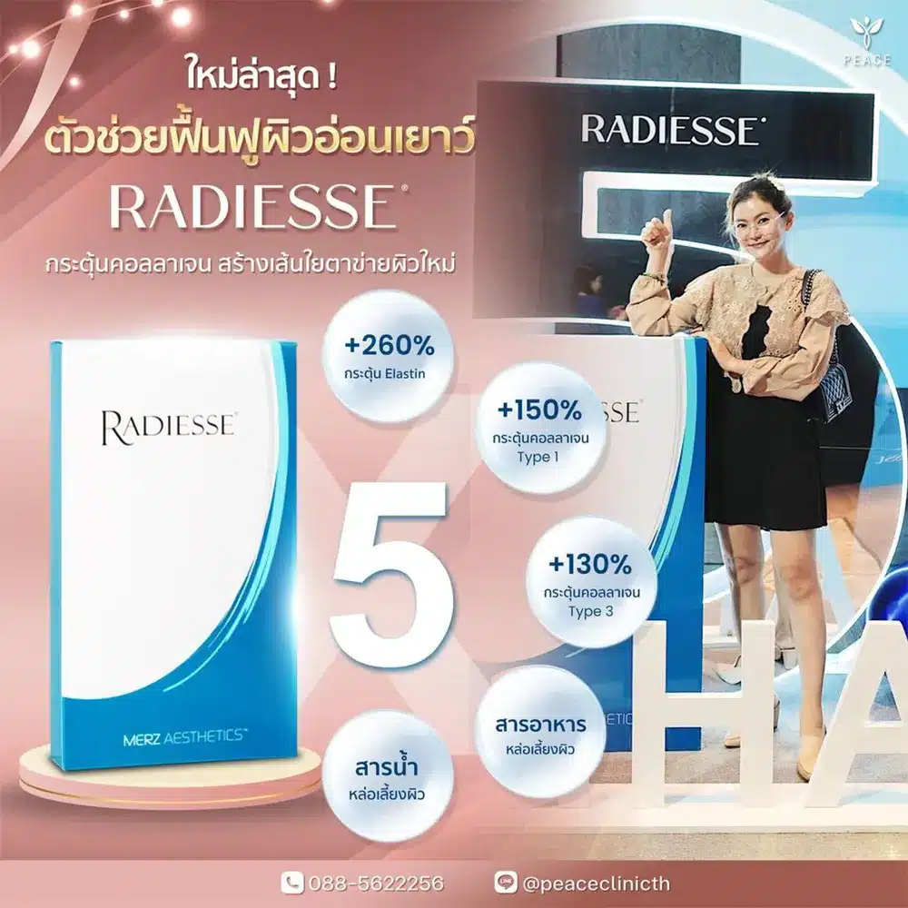 Radiesse แม่สอด